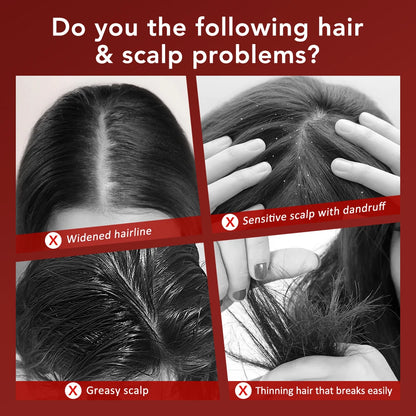 Oil-Infused Scalp Massager